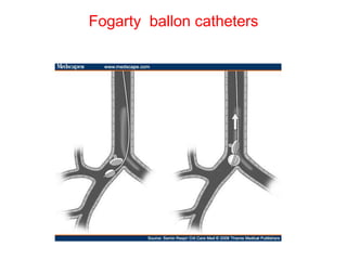 Fogarty ballon catheters
 