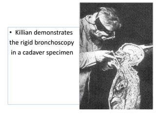 • Killian demonstrates
the rigid bronchoscopy
in a cadaver specimen
 