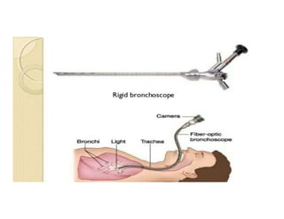 bronchoscopy 2022 .....pdf
