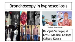 Bronchoscopy in kyphoscoliosis
Dr Vijish Venugopal
KMCT Medical College
Calicut, Kerala
 