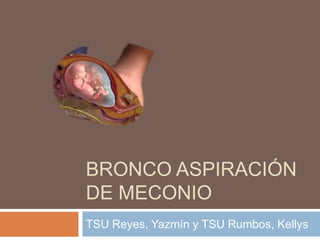 BRONCO ASPIRACIÓN
DE MECONIO
TSU Reyes, Yazmín y TSU Rumbos, Kellys

 