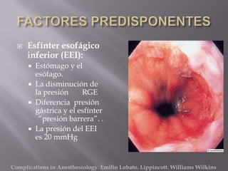    Esfínter esofágico
      inferior (EEI):
         Estómago y el
          esófago.
         La disminución de
          la presión     RGE
         Diferencia presión
          gástrica y el esfínter
           “presión barrera”. .
         La presión del EEI
          es 20 mmHg


Complications in Anesthesiology. Emilio Lobato. Lippincott. Williams Wilkins
 