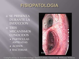    SE PRESENTA
      DURANTE LA
      INDUCCION
     TRES
      MECANISMOS
      CONOCIDOS
         PARTICULAS
          ASPIRADAS
         ACIDOS
         BACTERIAS

Complications in Anesthesiology. Emilio Lobato. Lippincott. Williams Wilkins
 