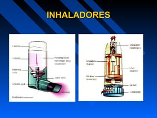 INHALADORESINHALADORES
 