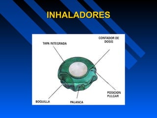 INHALADORESINHALADORES
 