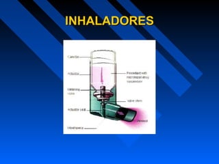 INHALADORESINHALADORES
 