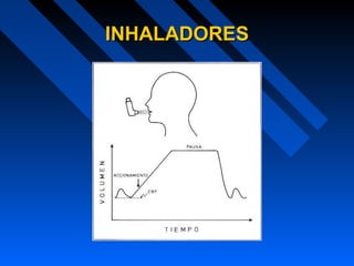 INHALADORESINHALADORES
 