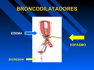 BRONCODILATADORESBRONCODILATADORES
EDEMA
SECRESION
ESPASMO
 