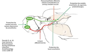 Pascale D. et. Al.
Case Scenario:
Bronchospasm
during anesthesia
induction.
Anesthesiology
114;5:1200-10
 