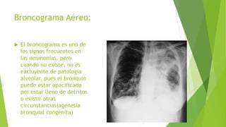 Broncograma Aéreo:
 El broncograma es uno de
los signos frecuentes en
las neumonías, pero
cuando no existe, no es
excluyente de patología
alveolar, pues el bronquio
puede estar opacificado
por estar lleno de detritos
o existir otras
circunstancias(agenesia
bronquial congénita)
 