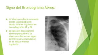 Signo del Broncograma Aéreo:
 La silueta cardíaca a menudo
oculta la patología del
lóbulo inferior izquierdo en
las radiografías AP y PA
 El signo del broncograma
aéreo superpuesto a la
silueta cardíaca es el signo
definitivo de consolidación
en el lóbulo inferior
izquierdo
 