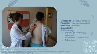 Inspección - cianosis, polipnea
Palpacion - fremito bronqila (+)
Percusion - matidez
Auscultacion
Ruido patologico
- Pulmón en tormenta o
racamier
- Estertores / crepitantes
- Sibilancias
Reyes, M. Neumologia. (2012) 3er ed. Editorial medica internacional. P271-298, Mexico
Pablo Cortés Borrego (2001) Bronconeumonía: ¿A qué se reﬁeren los pediatras cuando la diagnostican? Medigraphic. Sitio web:
https://www.medigraphic.com/pdfs/iner/in-2001/in013a.pdf
 