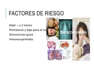 FACTORES DE RIESGO
Edad < a 3 meses
Prematurez y bajo peso al nacer
Desnutrición grave
Inmunosuprimidos
 