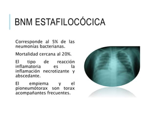 BNM ESTAFILOCÓCICA
Corresponde al 5% de las
neumonías bacterianas.
Mortalidad cercana al 20%.
El tipo de reacción
inflamatoria es la
inflamación necrotizante y
abscedante.
El empiema y el
pioneumótorax son torax
acompañantes frecuentes.
 