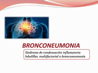 BRONCONEUMONIA
Síndrome de condensación inflamatoria
lobulillar, multifactorial o bronconeumonía
 