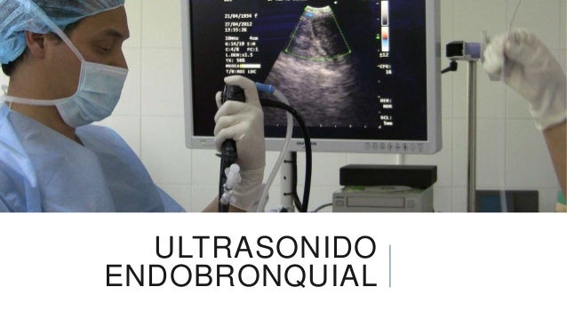 Broncoscopía rígida y flexible y ultrasonografía endobronquial