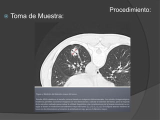 Procedimiento:Toma de Muestra: