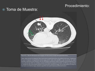 Procedimiento:Toma de Muestra: