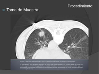Procedimiento:Toma de Muestra: