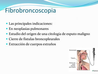 Las principales indicaciones:En neoplasias pulmonares Estudio del origen de una citología de esputo malignoCierre de fistulas broncopleuralesExtracción de cuerpos extrañosFibrobroncoscopia 