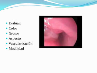 Evaluar: ColorGrosorAspectoVascularizaciónMovilidad 