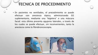 TECNICA DE PROCEDIMIENTO
• En pacientes no ventilados, el procedimiento se puede
efectuar con anestesia tópica, administrando O2
suplementario, mediante una “bigotera” o una máscara
facial: esta última presenta agujeros laterales, a través de
los cuales se puede efectuar, sin inconvenientes, tanto la
anestesia como la fibrobroncoscopia.
Alberto López Aráoz. Broncoscopia para clínicos y neumólogos.
 