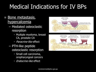 Medical Indications for IV BPs
 Bone metastasis,
hypercalcemia
– Mediated osteoclastic
resorption
 Multiple myeloma, breast
CA, prostate CA
 Paracrine-like effect
– PTH-like peptide
osteoclastic resorption
 Small cell carcinoma,
oropharyngeal cancers
 Endocrine-like effect
ismohammed@phcc.gov.qa
 