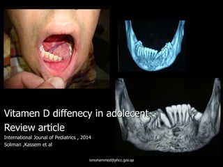 ismohammed@phcc.gov.qa
Vitamen D diffenecy in adolecent
Review article
International Jounal of Pediatrics , 2014
Soliman ,Kassem et al
 