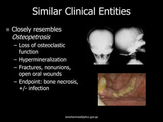 Similar Clinical Entities
 Closely resembles
Osteopetrosis
– Loss of osteoclastic
function
– Hypermineralization
– Fractures, nonunions,
open oral wounds
– Endpoint: bone necrosis,
+/- infection
ismohammed@phcc.gov.qa
 