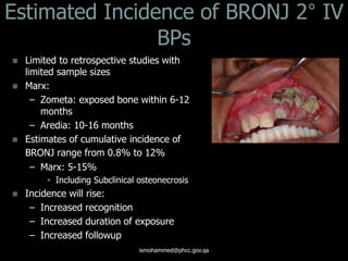 Estimated Incidence of BRONJ 2° IV
BPs
 Limited to retrospective studies with
limited sample sizes
 Marx:
– Zometa: exposed bone within 6-12
months
– Aredia: 10-16 months
 Estimates of cumulative incidence of
BRONJ range from 0.8% to 12%
– Marx: 5-15%
 Including Subclinical osteonecrosis
 Incidence will rise:
– Increased recognition
– Increased duration of exposure
– Increased followup
ismohammed@phcc.gov.qa
 