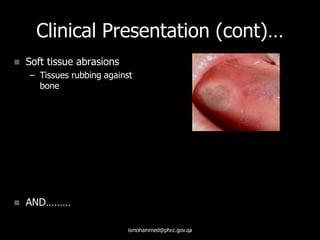 Clinical Presentation (cont)…
 Soft tissue abrasions
– Tissues rubbing against
bone
 AND………
ismohammed@phcc.gov.qa
 