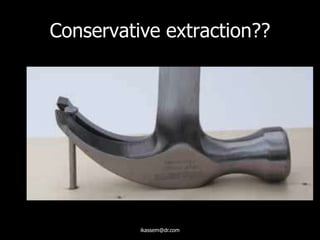 Conservative extraction??
ikassem@dr.com
 