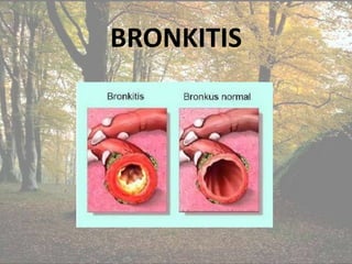 BRONKITIS 