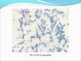 HE ve PAS ile aspergillus
 