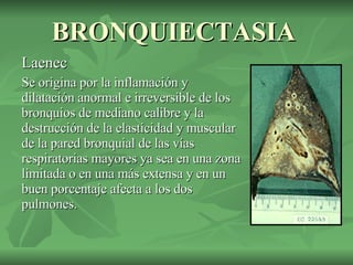 BRONQUIECTASIA Laenec Se origina por la inflamación y dilatación anormal e irreversible de los bronquios de mediano calibre y la destrucción de la elasticidad y muscular de la pared bronquial de las vías respiratorias mayores ya sea en una zona limitada o en una más extensa y en un buen porcentaje afecta a los dos pulmones.  