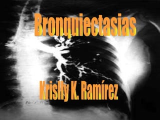 Bronquiectasias Krislly K. Ramírez  