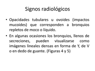 Signos radiológicos
• Opacidades tubulares u ovoides (impactos
mucoides) que corresponden a bronquios
repletos de moco o líquido.
• En algunas ocasiones los bronquios, llenos de
secreciones, pueden visualizarse como
imágenes lineales densas en forma de Y, de V
o en dedo de guante. (Figuras 4 y 5)

 