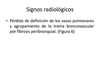 Signos radiológicos
• Pérdida de definición de los vasos pulmonares
y agrupamiento de la trama broncovascular
por fibrosis peribronquial. (Figura 6)

 