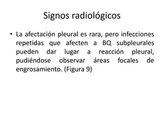 Signos radiológicos
• La afectación pleural es rara, pero infecciones
repetidas que afecten a BQ subpleurales
pueden dar lugar a reacción pleural,
pudiéndose observar áreas focales de
engrosamiento. (Figura 9)

 