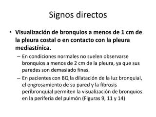 Signos directos
• Visualización de bronquios a menos de 1 cm de
la pleura costal o en contacto con la pleura
mediastínica.
– En condiciones normales no suelen observarse
bronquios a menos de 2 cm de la pleura, ya que sus
paredes son demasiado finas.
– En pacientes con BQ la dilatación de la luz bronquial,
el engrosamiento de su pared y la fibrosis
peribronquial permiten la visualización de bronquios
en la periferia del pulmón (Figuras 9, 11 y 14)

 