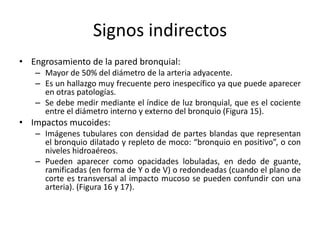 Signos indirectos
• Engrosamiento de la pared bronquial:
– Mayor de 50% del diámetro de la arteria adyacente.
– Es un hallazgo muy frecuente pero inespecífico ya que puede aparecer
en otras patologías.
– Se debe medir mediante el índice de luz bronquial, que es el cociente
entre el diámetro interno y externo del bronquio (Figura 15).

• Impactos mucoides:
– Imágenes tubulares con densidad de partes blandas que representan
el bronquio dilatado y repleto de moco: “bronquio en positivo”, o con
niveles hidroaéreos.
– Pueden aparecer como opacidades lobuladas, en dedo de guante,
ramificadas (en forma de Y o de V) o redondeadas (cuando el plano de
corte es transversal al impacto mucoso se pueden confundir con una
arteria). (Figura 16 y 17).

 