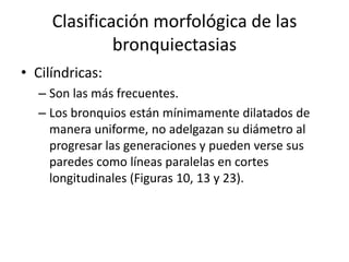 Clasificación morfológica de las
bronquiectasias
• Cilíndricas:
– Son las más frecuentes.
– Los bronquios están mínimamente dilatados de
manera uniforme, no adelgazan su diámetro al
progresar las generaciones y pueden verse sus
paredes como líneas paralelas en cortes
longitudinales (Figuras 10, 13 y 23).

 