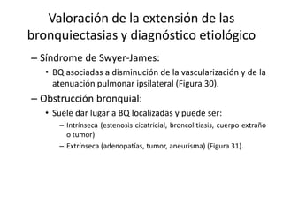 Valoración de la extensión de las
bronquiectasias y diagnóstico etiológico
– Síndrome de Swyer-James:
• BQ asociadas a disminución de la vascularización y de la
atenuación pulmonar ipsilateral (Figura 30).

– Obstrucción bronquial:
• Suele dar lugar a BQ localizadas y puede ser:
– Intrínseca (estenosis cicatricial, broncolitiasis, cuerpo extraño
o tumor)
– Extrínseca (adenopatías, tumor, aneurisma) (Figura 31).

 