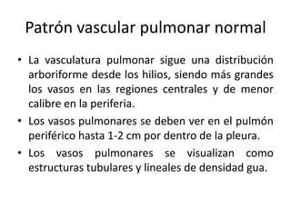 Patrón vascular pulmonar normal
• La vasculatura pulmonar sigue una distribución
arboriforme desde los hilios, siendo más grandes
los vasos en las regiones centrales y de menor
calibre en la periferia.
• Los vasos pulmonares se deben ver en el pulmón
periférico hasta 1-2 cm por dentro de la pleura.
• Los vasos pulmonares se visualizan como
estructuras tubulares y lineales de densidad gua.

 