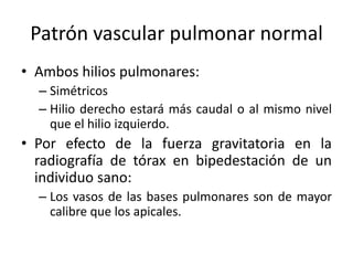 Patrón vascular pulmonar normal
• Ambos hilios pulmonares:
– Simétricos
– Hilio derecho estará más caudal o al mismo nivel
que el hilio izquierdo.

• Por efecto de la fuerza gravitatoria en la
radiografía de tórax en bipedestación de un
individuo sano:
– Los vasos de las bases pulmonares son de mayor
calibre que los apicales.

 