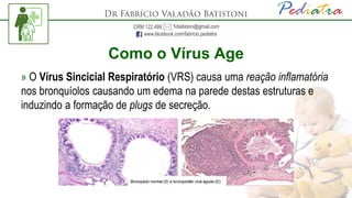» O Vírus Sincicial Respiratório (VRS) causa uma reação inflamatória
nos bronquíolos causando um edema na parede destas estruturas e
induzindo a formação de plugs de secreção.
Como o Vírus Age
 