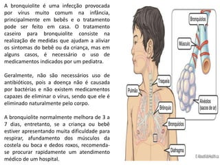A bronquiolite é uma infecção provocada
por vírus muito comum na infância,
principalmente em bebês e o tratamento
pode ser feito em casa. O tratamento
caseiro para bronquiolite consiste na
realização de medidas que ajudam a aliviar
os sintomas do bebê ou da criança, mas em
alguns casos, é necessário o uso de
medicamentos indicados por um pediatra.
Geralmente, não são necessários uso de
antibióticos, pois a doença não é causada
por bactérias e não existem medicamentos
capazes de eliminar o vírus, sendo que ele é
eliminado naturalmente pelo corpo.
A bronquiolite normalmente melhora de 3 a
7 dias, entretanto, se a criança ou bebê
estiver apresentando muita dificuldade para
respirar, afundamento dos músculos da
costela ou boca e dedos roxos, recomenda-
se procurar rapidamente um atendimento
médico de um hospital.
 