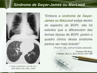 Síndrome de Swyer-James ou MacLeod
“Embora a síndrome de Swyer-
James ou MacLeod esteja dentro
do espectro da BOPI, não há
estudos que a diferenciem das
formas típicas de BOPI, porém o
quadro clínico dessa síndrome
parece ser mais brando”
(Fischer GB, comunicação pessoal).
J. bras. pneumol. vol.30 no.1
São Paulo Jan./Feb. 2004
Champs NS et al.
J Pediatr (Rio J). 2011;87(3):187-198
 
