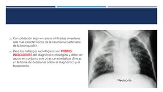  Consolidación segmentaria e infiltrados alveolares 
son más característicos de la neumonía bacteriana 
de la bronquiolitis 
 Pero los hallazgos radiológicos son POBRES 
INDICADORES del diagnóstico etiológico y debe ser 
usado en conjunto con otras características clínicas 
en la toma de decisiones sobre el diagnóstico y el 
tratamiento. 
Neumonía 
 