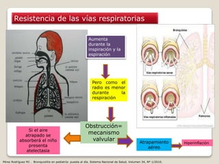 Resistencia de las vías respiratorias
Aumenta
durante la
inspiración y la
espiración
Pero como el
radio es menor
durante la
respiración
Obstrucción=
mecanismo
valvular Atrapamiento
aéreo
Hiperinflación
Si el aire
atrapado se
absorberá el niño
presenta
atelectasia
Pérez Rodríguez MJ . Bronquiolitis en pediatría: puesta al día. Sistema Nacional de Salud. Volumen 34, Nº 1/2010.
 